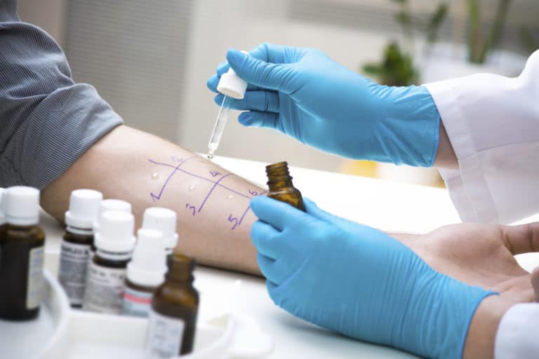 Allergist administering a skin test